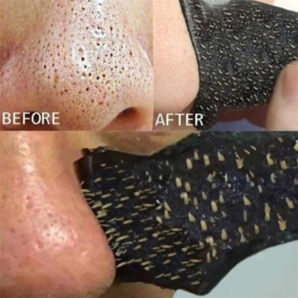 Nose Blackhead Remover Mask Nasal Strips Black Head Nose Dot Spot Peel Skin Care Shrink Pore Black dots Pore Clean Strips - Image 13