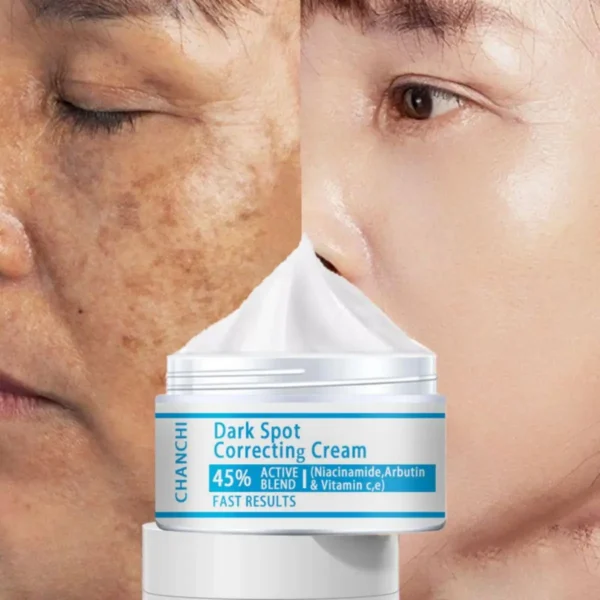 Whitening Freckles Cream Remove Melasma Dark Spot Lightening Melanin Brightening Melasma Remover Moisturize Anti-aging Face Care - Image 6