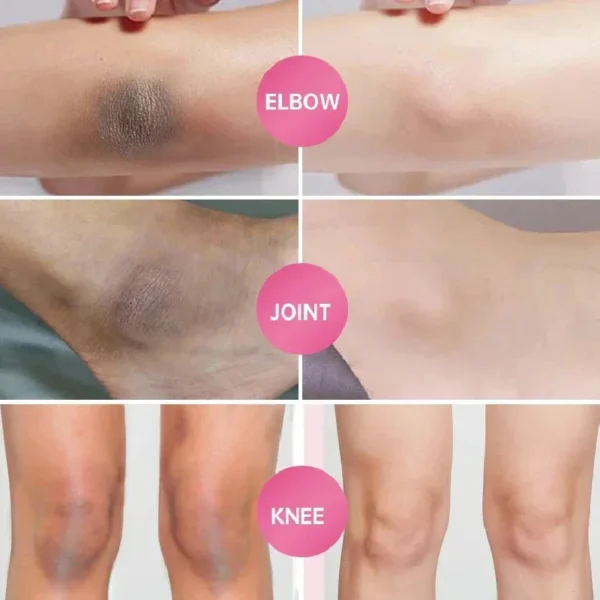 Whitening Cream For Dark Skin Armpit Thigh Inner Joint Lightening Intimate Area Underarm Body Care Private Parts Brighten Lotion - Image 2