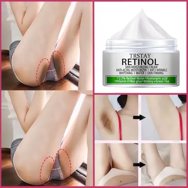 Armpit Whitening Cream Skin Lightening Bleaching Cream For Underarm Dark Skin Legs Knees Whitening Intimate Body Lotion - Image 4