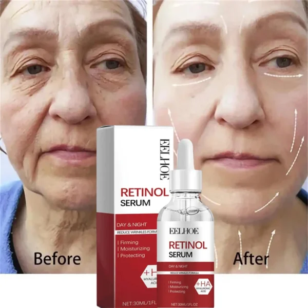 Retinol Wrinkle Remover Face Set Instant Firming Lifting Anti-Aging Serum Fade Fine Lines Whitening Korean Skin Care Products - Image 20