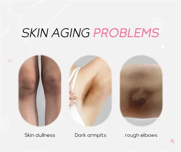 Whitening Cream For Dark Skin Armpit Thigh Inner Joint Lightening Intimate Area Underarm Body Care Private Parts Brighten Lotion - Image 14