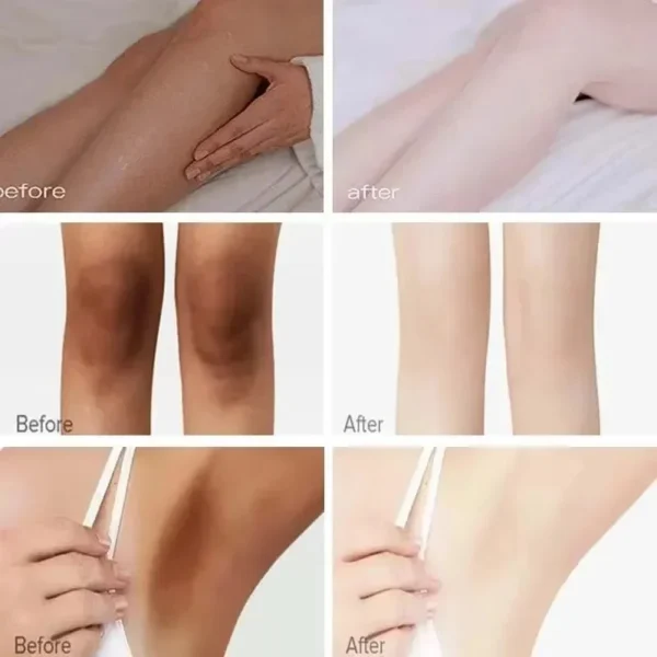 Whitening Cream Private Parts Underarm Bleaching Whiten Butt Knee Brighten Inner Thigh Intimate Parts Dark Remove Melanin Care - Image 12