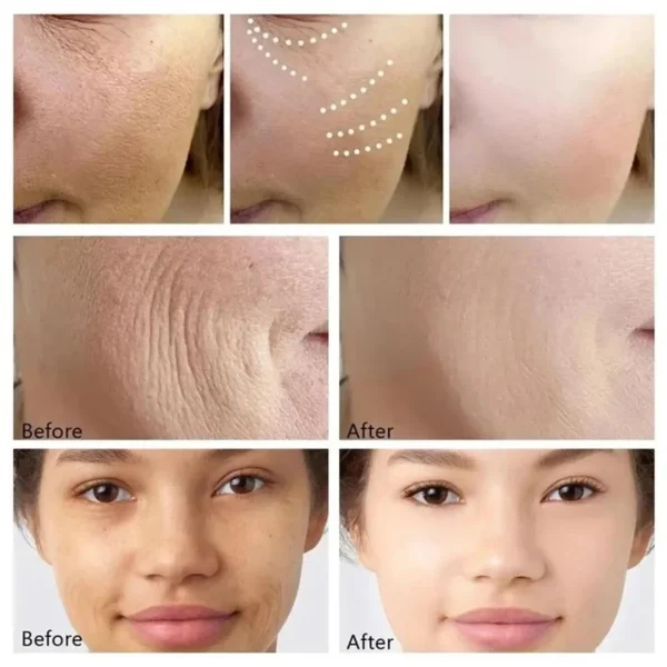 Retinol Wrinkle Remover Face Set Instant Firming Lifting Anti-Aging Serum Fade Fine Lines Whitening Korean Skin Care Products - Image 13