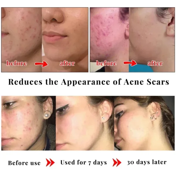 Body Whitening Soap Underarm Knee Bleaching Soap Chicken Skin Removal Dark Spot Removal Dead Skin Moisturize Brighten Body Care - Image 4