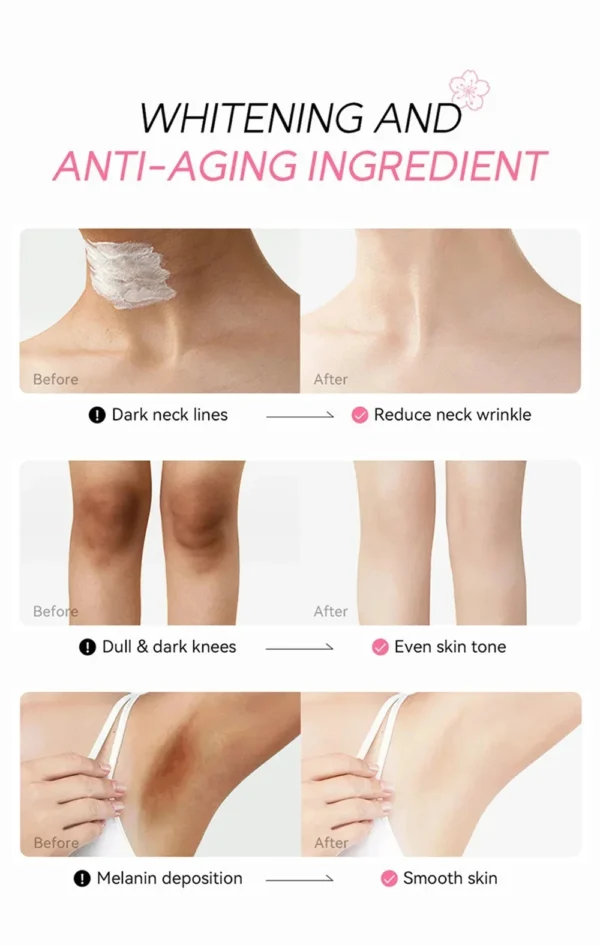 Whitening Cream For Dark Skin Armpit Thigh Inner Joint Lightening Intimate Area Underarm Body Care Private Parts Brighten Lotion - Image 20