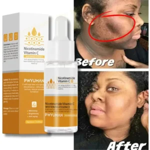 Vitamin C Whitening Serum Face Remove Dark Spots Freckles Fade Melanin Retinol Anti-wrinkle Essence Brightening Korean Skin Care