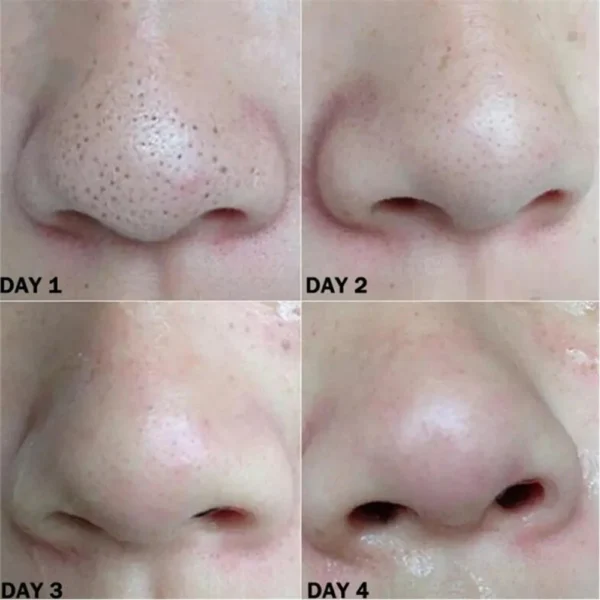 Nose Blackhead Remover Mask Nasal Strips Black Head Nose Dot Spot Peel Skin Care Shrink Pore Black dots Pore Clean Strips - Image 14