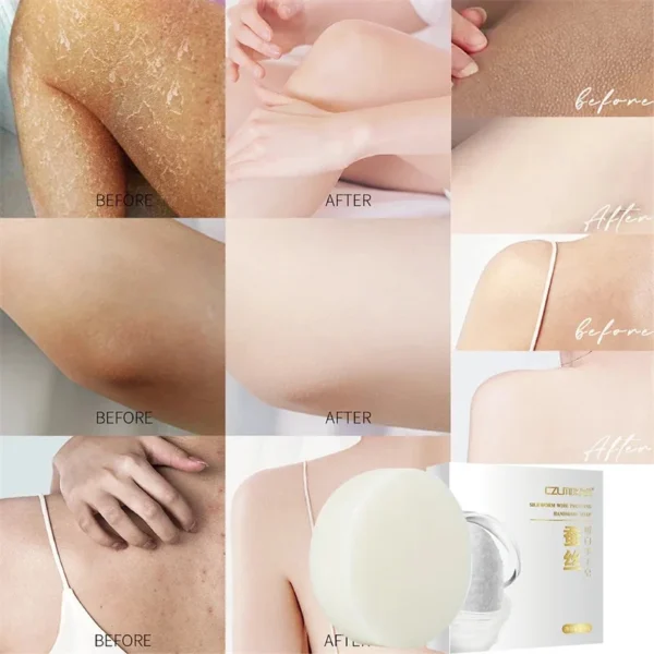 Body Whitening Soap Underarm Knee Bleaching Soap Chicken Skin Removal Dark Spot Removal Dead Skin Moisturize Brighten Body Care - Image 11
