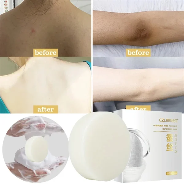 Body Whitening Soap Underarm Knee Bleaching Soap Chicken Skin Removal Dark Spot Removal Dead Skin Moisturize Brighten Body Care - Image 12