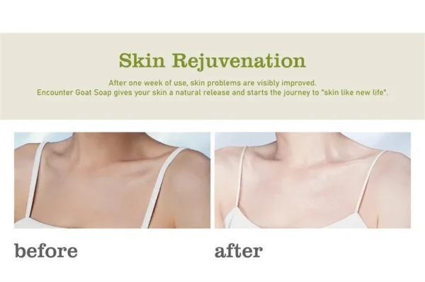 Body Whitening Soap Underarm Knee Bleaching Soap Chicken Skin Removal Dark Spot Removal Dead Skin Moisturize Brighten Body Care - Image 24