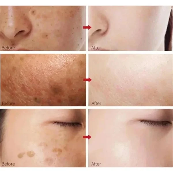 Vitamin C Whitening Serum Face Remove Dark Spots Freckles Fade Melanin Retinol Anti-wrinkle Essence Brightening Korean Skin Care - Image 10