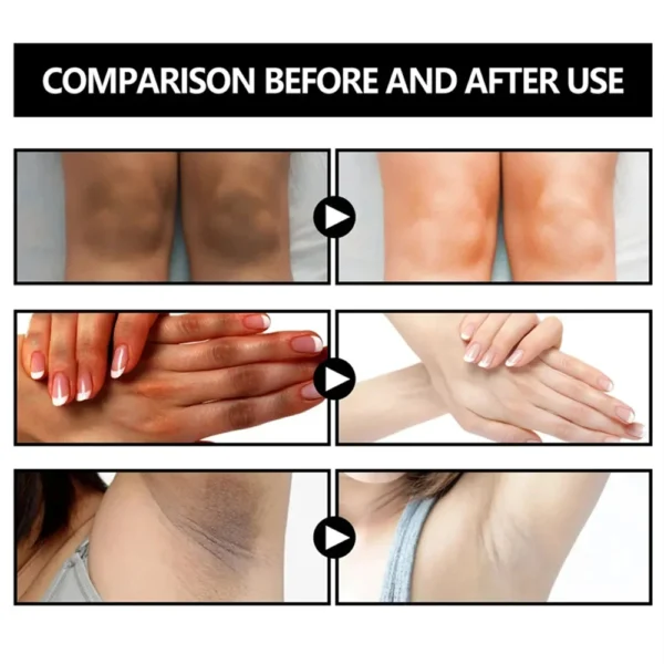 Body Whitening Soap Underarm Knee Bleaching Soap Chicken Skin Removal Dark Spot Removal Dead Skin Moisturize Brighten Body Care - Image 10