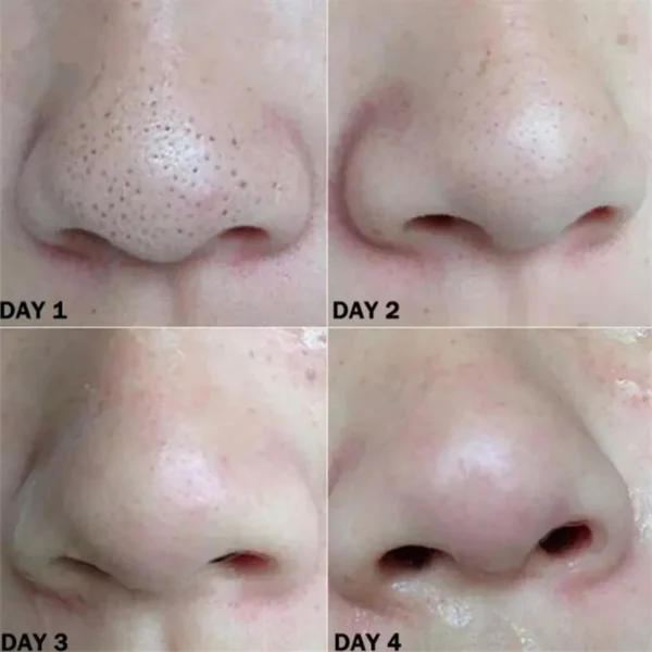 Nose Blackhead Remover Mask Nasal Strips Black Head Nose Dot Spot Peel Skin Care Shrink Pore Black dots Pore Clean Strips - Image 3