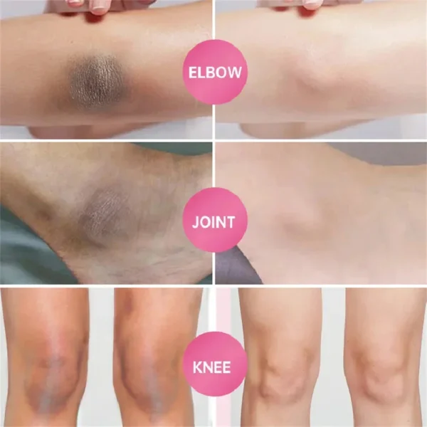 Whitening Cream For Dark Skin Armpit Thigh Inner Joint Lightening Intimate Area Underarm Body Care Private Parts Brighten Lotion - Image 10