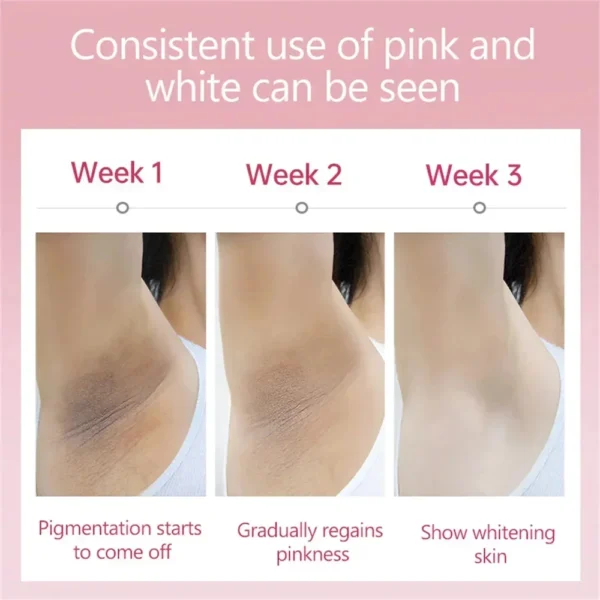 Whitening Cream For Dark Skin Armpit Thigh Inner Joint Lightening Intimate Area Underarm Body Care Private Parts Brighten Lotion - Image 13