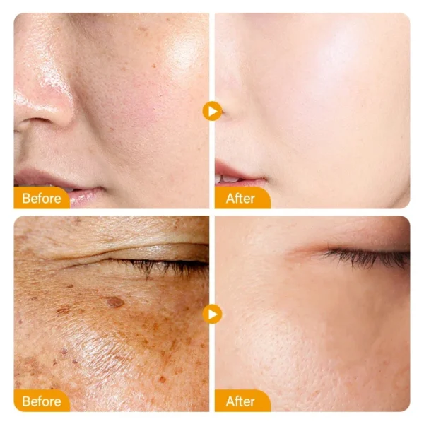 Vitamin C Whitening Serum Face Remove Dark Spots Freckles Fade Melanin Retinol Anti-wrinkle Essence Brightening Korean Skin Care - Image 5