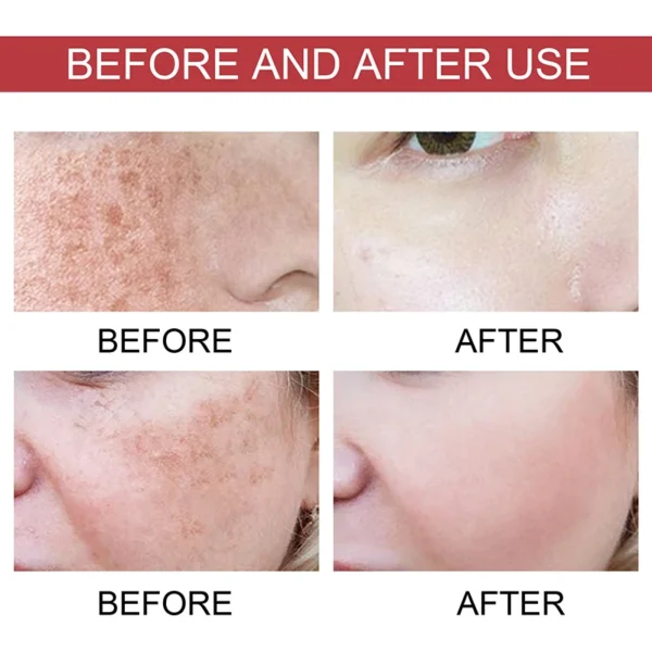 Niacinamide Serum Dark Spot Correcting Moisturizing Brightening Fade Fine Lines Deep Cleaning Makeup Remover Korean Skin Care - Image 2