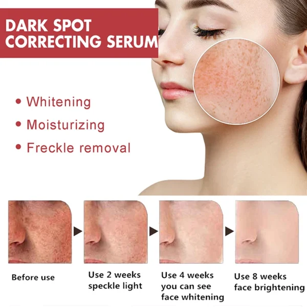 Niacinamide Serum Dark Spot Correcting Moisturizing Brightening Fade Fine Lines Deep Cleaning Makeup Remover Korean Skin Care - Image 4