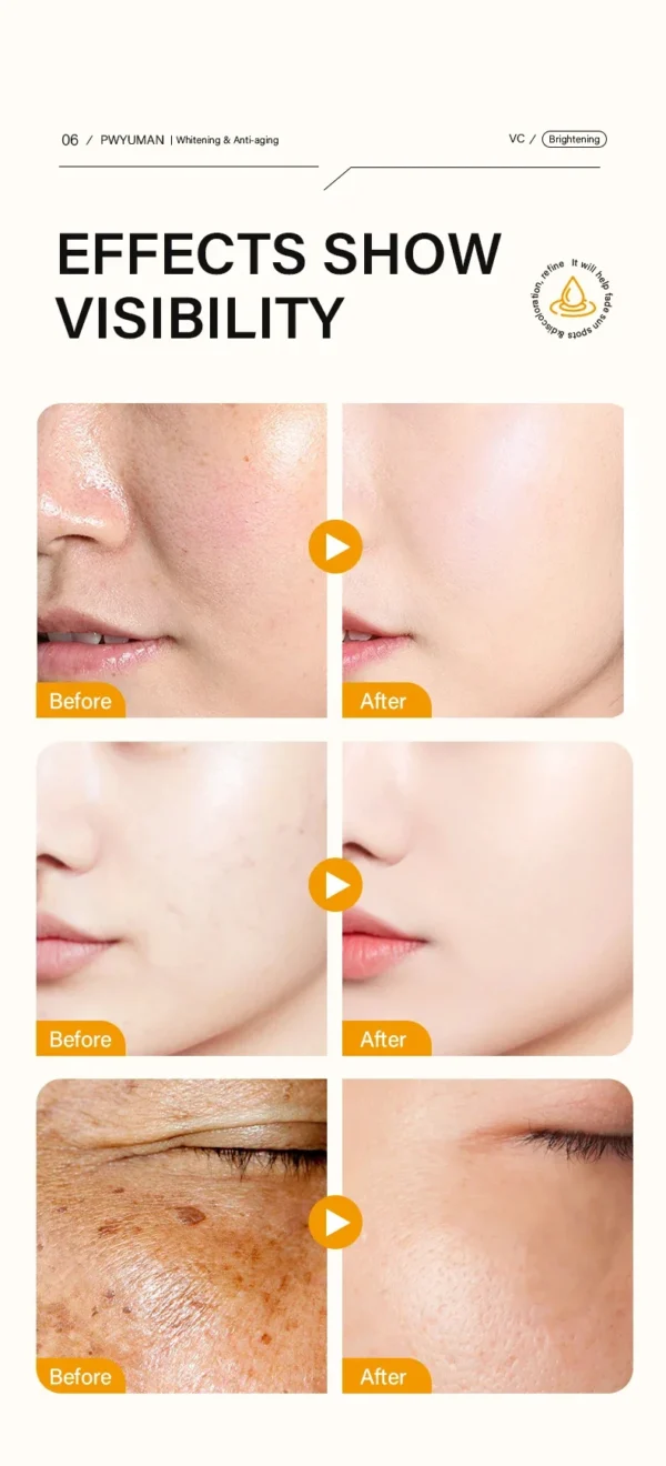 Vitamin C Whitening Serum Face Remove Dark Spots Freckles Fade Melanin Retinol Anti-wrinkle Essence Brightening Korean Skin Care - Image 16