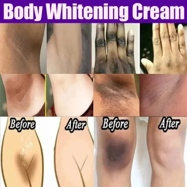 Whitening Cream Private Parts Underarm Bleaching Whiten Butt Knee Brighten Inner Thigh Intimate Parts Dark Remove Melanin Care - Image 4