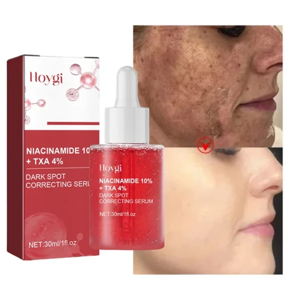 Niacinamide Serum Dark Spot Correcting Moisturizing Brightening Fade Fine Lines Deep Cleaning Makeup Remover Korean Skin Care - Image 9