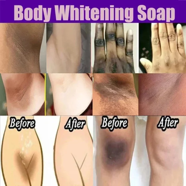 Body Whitening Soap Underarm Knee Bleaching Soap Chicken Skin Removal Dark Spot Removal Dead Skin Moisturize Brighten Body Care - Image 3