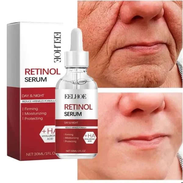 Retinol Wrinkle Remover Face Set Instant Firming Lifting Anti-Aging Serum Fade Fine Lines Whitening Korean Skin Care Products - Image 8