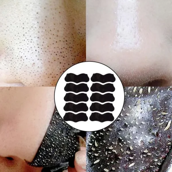 Nose Blackhead Remover Mask Nasal Strips Black Head Nose Dot Spot Peel Skin Care Shrink Pore Black dots Pore Clean Strips - Image 2