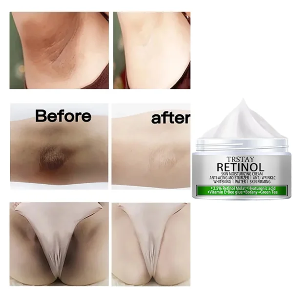 Armpit Whitening Cream Skin Lightening Bleaching Cream For Underarm Dark Skin Legs Knees Whitening Intimate Body Lotion - Image 2