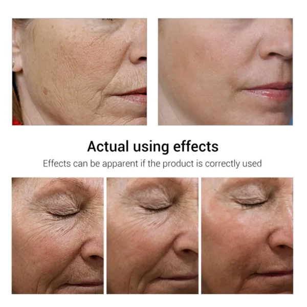 Retinol Wrinkle Remover Face Set Instant Firming Lifting Anti-Aging Serum Fade Fine Lines Whitening Korean Skin Care Products - Image 23
