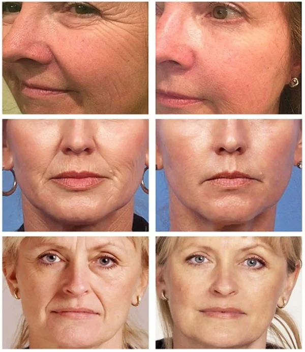 Retinol Wrinkle Remover Face Set Instant Firming Lifting Anti-Aging Serum Fade Fine Lines Whitening Korean Skin Care Products - Image 14
