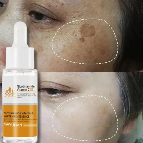 Vitamin C Whitening Serum Face Remove Dark Spots Freckles Fade Melanin Retinol Anti-wrinkle Essence Brightening Korean Skin Care - Image 2