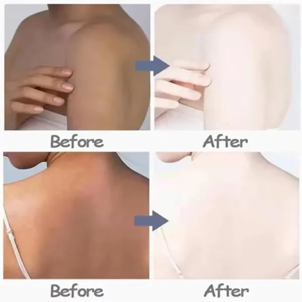 Armpit Whitening Cream Skin Lightening Bleaching Cream For Underarm Dark Skin Legs Knees Whitening Intimate Body Lotion - Image 5