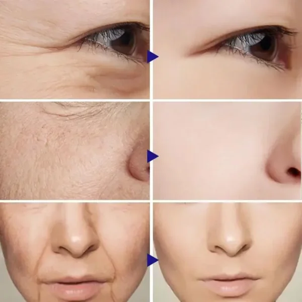 Retinol Wrinkle Remover Face Set Instant Firming Lifting Anti-Aging Serum Fade Fine Lines Whitening Korean Skin Care Products - Image 2