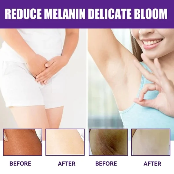 Whitening Cream Private Parts Underarm Bleaching Whiten Butt Knee Brighten Inner Thigh Intimate Parts Dark Remove Melanin Care - Image 3