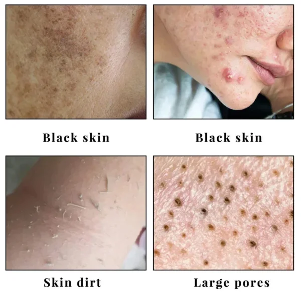 Body Whitening Soap Underarm Knee Bleaching Soap Chicken Skin Removal Dark Spot Removal Dead Skin Moisturize Brighten Body Care - Image 5