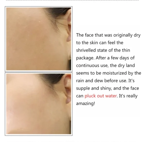 2% Hyaluronic Acid + B5 Serum Moisturizing Nourishing Dry Smooth Face Skin Care Firming Oil Control Multi-effect Facial Essence - Image 8