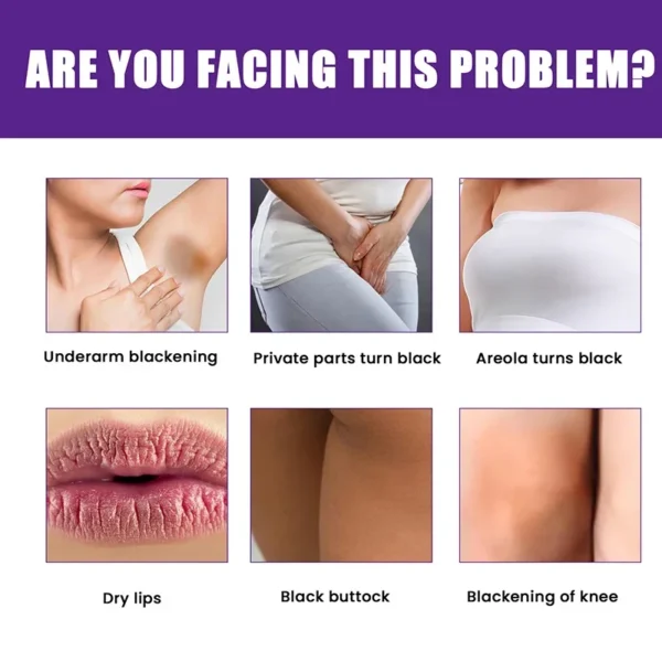Whitening Cream Private Parts Underarm Bleaching Whiten Butt Knee Brighten Inner Thigh Intimate Parts Dark Remove Melanin Care - Image 11