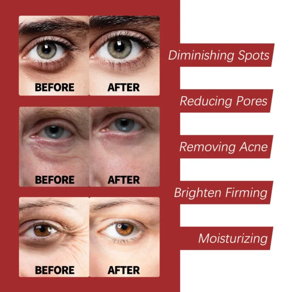 Retinol Wrinkle Remover Face Set Instant Firming Lifting Anti-Aging Serum Fade Fine Lines Whitening Korean Skin Care Products - Image 17