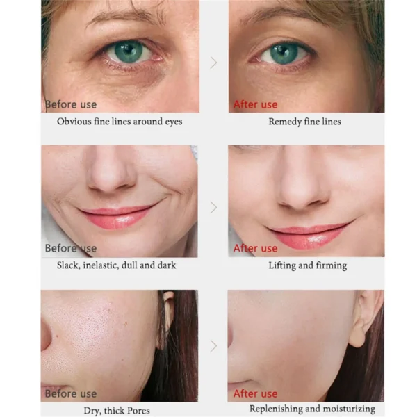 Retinol Wrinkle Remover Face Set Instant Firming Lifting Anti-Aging Serum Fade Fine Lines Whitening Korean Skin Care Products - Image 10